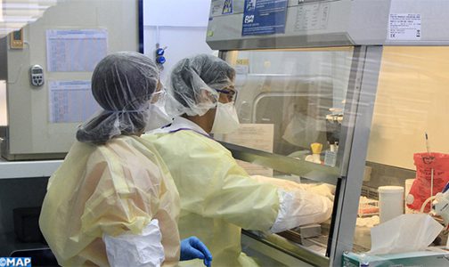 المستشفى الجهوي الحسن الثاني بأكادير أصبح يجري التحاليل المختبرية الخاصة بتشخيص الإصابة بمرض كورونا