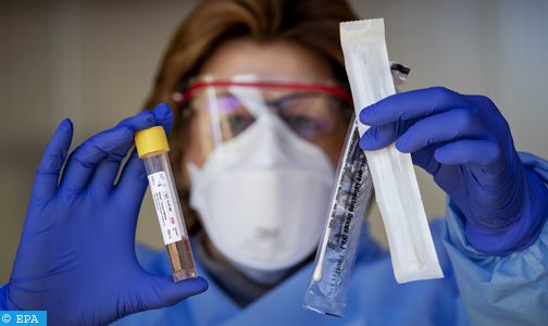 إسبانيا تعتزم فرض إجراء اختبارات الكشف عن فيروس ( كوفيد ـ 19 ) على المسافرين القادمين من دول ذات معدلات إصابة مرتفعة بالوباء