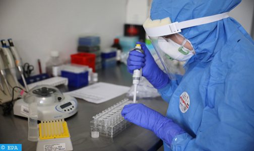 بولونيا : ابتكار دواء لفيروس كورونا من بلازما الدم