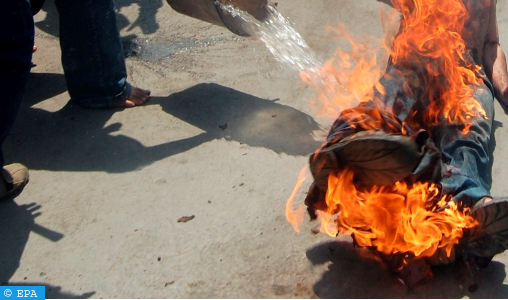 Un Algérien se tue en s’immolant par le feu dans l’ouest du pays