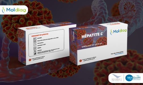 MAScIR: Moldiag lance le premier test 100% marocain de diagnostic de l’hépatite C